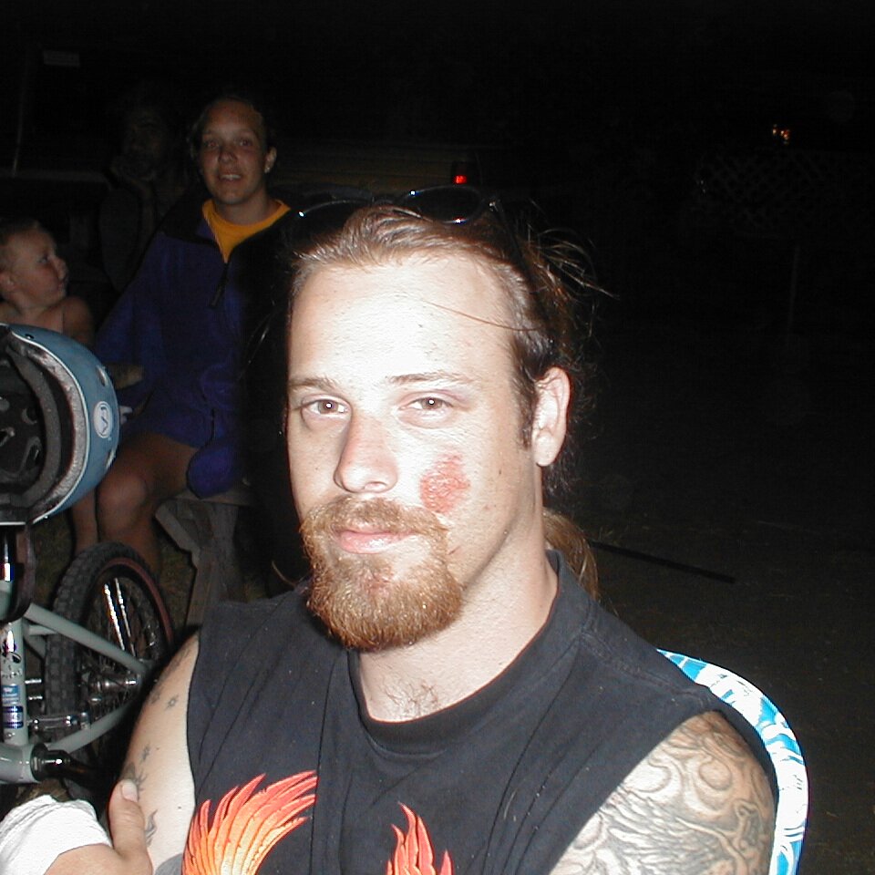 2000-06-28x20-07-00_Johnny_Bird_at_Lee_Webster_birthday Johnny Bird, with a little road rash, probably at Charlie Jackson's house. Good EXIF data so day and time correct.