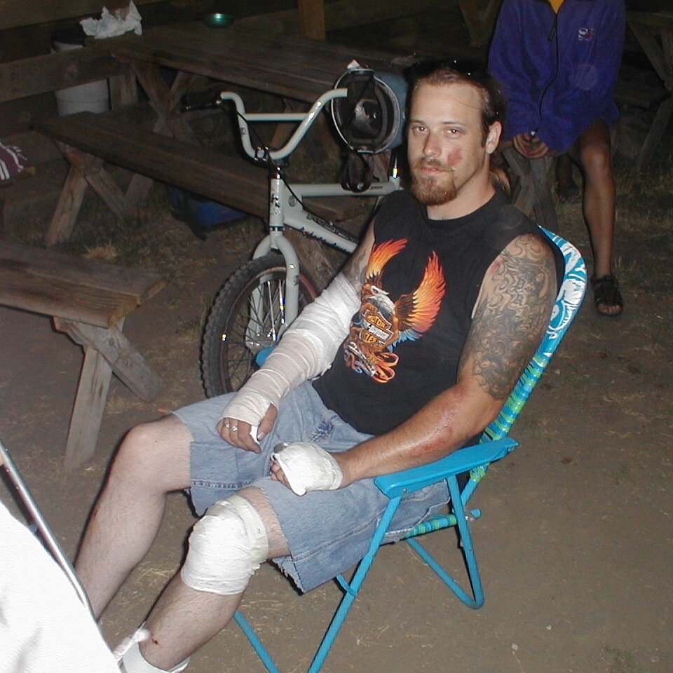 2000-06-28x20-08-09_Johnny_Bird_2_at_Lee_Webster_birthday Johnny Bird with more than a little road rash, probably at Charlie Jackson's house. EXIF date for correct day and time.